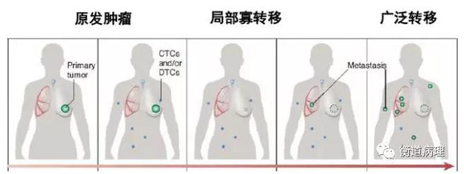 腫瘤輔助診斷 腫瘤輔助診斷