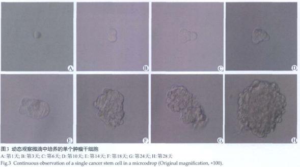 圖3 動態(tài)觀察微滴中培養(yǎng)的單個腫瘤干細胞 圖3 動態(tài)觀察微滴中培養(yǎng)的單個腫瘤干細胞