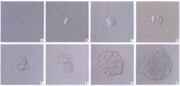 圖4 動態(tài)觀察96孔板培養(yǎng)的單個腫瘤干細胞 圖4 動態(tài)觀察96孔板培養(yǎng)的單個腫瘤干細胞