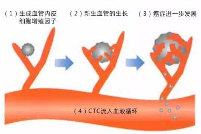 CTC檢查是測定血液中流動癌細胞的一種檢查 CTC檢查是測定血液中流動癌細胞的一種檢查