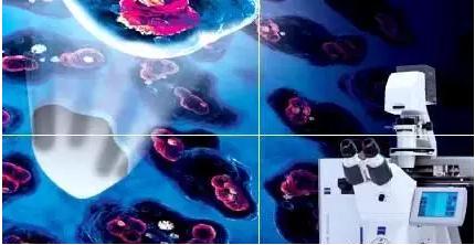 激光顯微切割技術(LCM) 激光顯微切割技術(LCM)