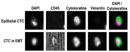 CellSearch 檢測CTCs代表性例子的結果示意圖
