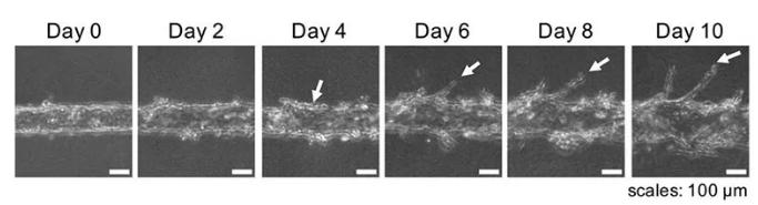 隨著時間的推移，可以用顯微鏡觀察到血管的新生。圖片來源：EBioMedicine