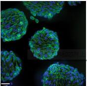 3D細胞培養微流控芯片
