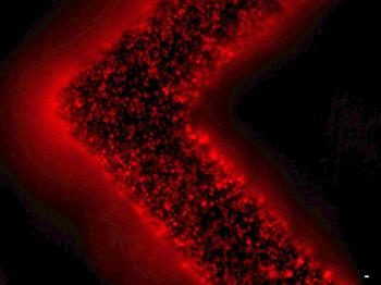 細胞外囊泡(紅色)從患者腫瘤細胞中釋放并被捕獲在EV-HB芯片表面。 細胞外囊泡(紅色)從患者腫瘤細胞中釋放并被捕獲在EV-HB芯片表面。