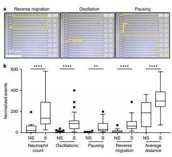 敗血癥特異性的中性粒細胞自發的遷移模式。 敗血癥特異性的中性粒細胞自發的遷移模式。
