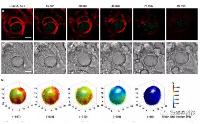 微流控技術開發微型彈性球,可用于癌癥診斷 微流控技術開發微型彈性球,可用于癌癥診斷