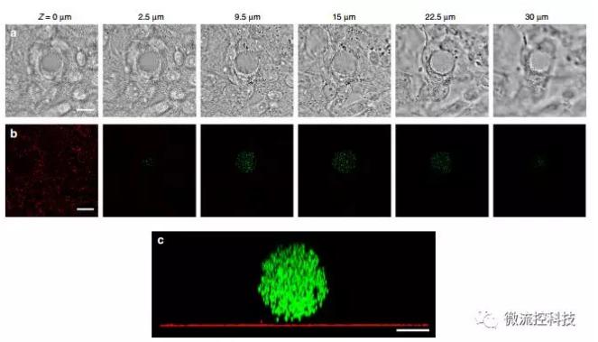 微流控技術開發微型彈性球,可用于癌癥診斷 微流控技術開發微型彈性球,可用于癌癥診斷