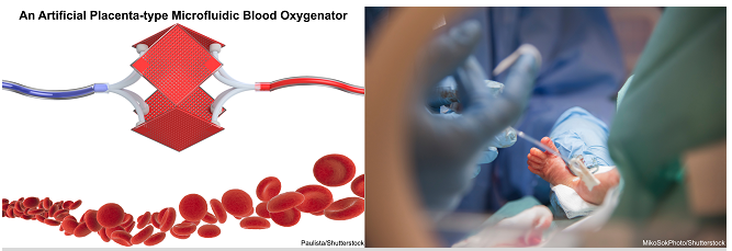 微加工技術解決早產兒肺功能不全的問題不再是夢 微加工技術解決早產兒肺功能不全的問題不再是夢