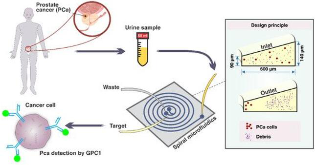 有望無創(chuàng)檢測前列腺癌的微流控芯片